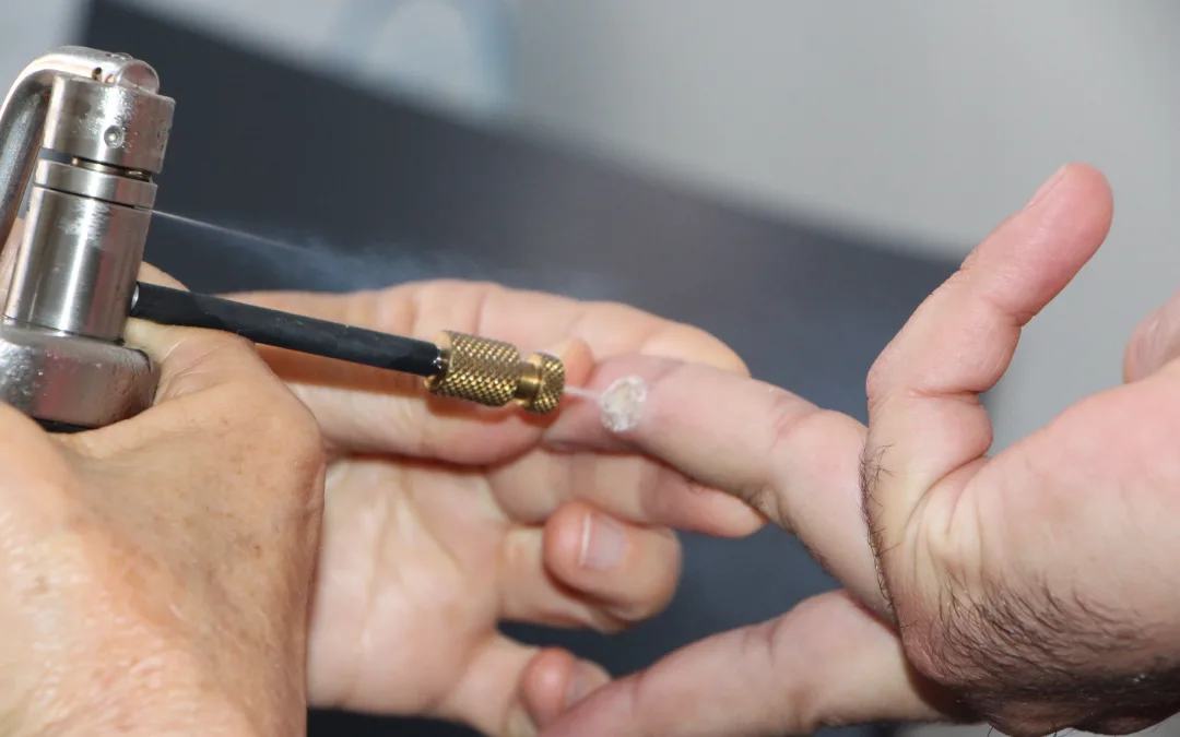 Rastreio gratuito do cancro da pele regressa a Alcoutim